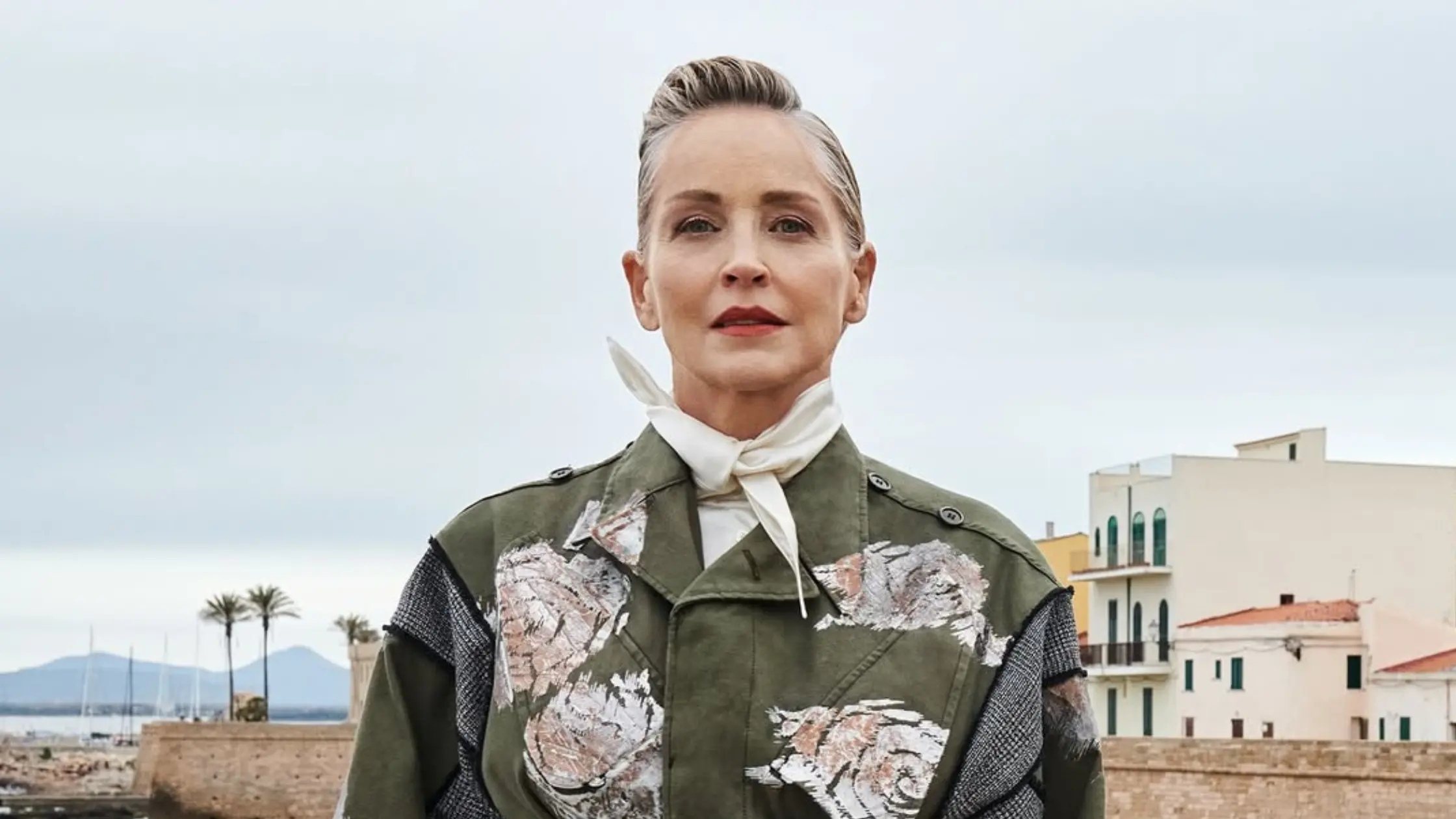 sharon stone hair loss recovery